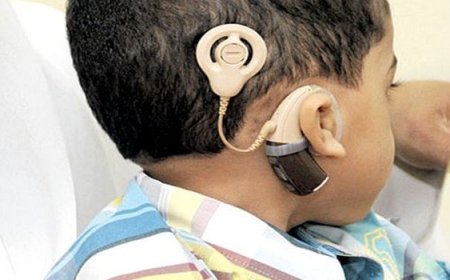 زراعة 10قواقع سمعية لأطفال بسكيكدة