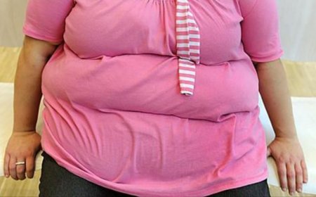 34 المائة من الجزائريات يعانين من السمنة