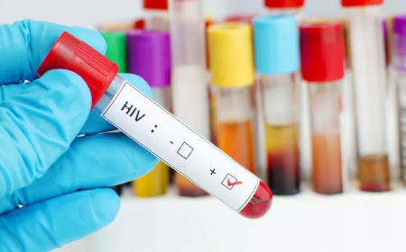  تسجيل 23 إصابة بالسيدا بتبسة