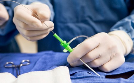 إجراء 04 عمليات قسطرة ناجحة لأول مرة بباتنة